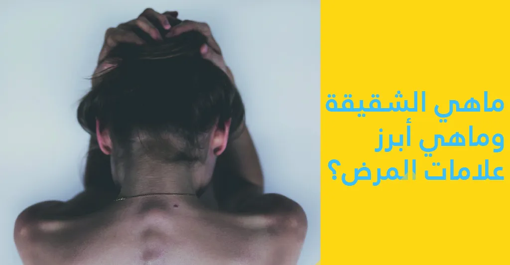 هل يوجد علاج لمرض الشقيقة أو الصّداع النّصفي ؟